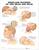 Whiplash Injuries of the Head and Neck Anatomical Chart