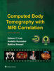 Computed Body Tomography with MRI Correlation