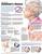 Understanding Alzheimer's Disease Anatomical Chart