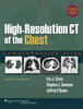 VitalSource E-book for High-Resolution CT of the Chest