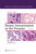 Biopsy Interpretation of the Prostate