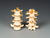 Budget Four-Part Lumbar Set