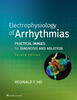 Electrophysiology of Arrhythmias