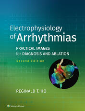 Electrophysiology of Arrhythmias
