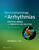 Electrophysiology of Arrhythmias
