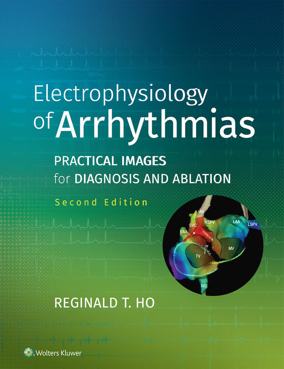 Electrophysiology of Arrhythmias