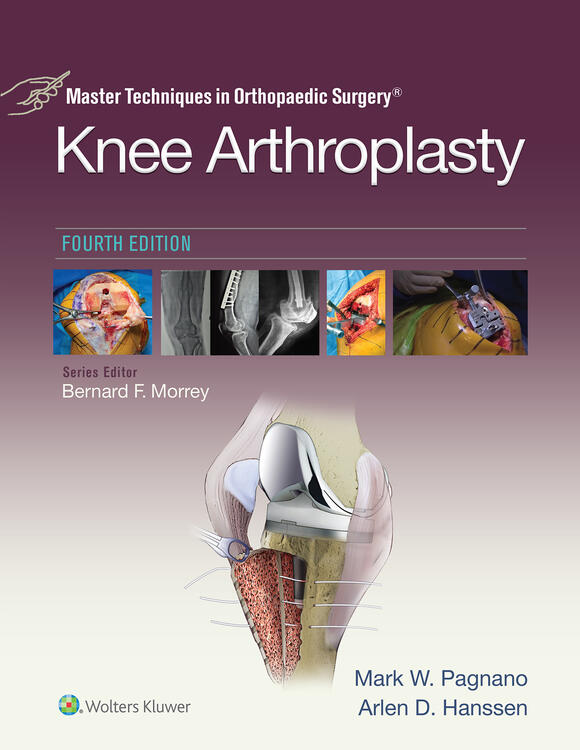 Master Techniques in Orthopedic Surgery: Knee Arthroplasty