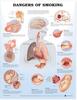 Dangers of Smoking Anatomical Chart
