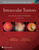 Intraocular Tumors: An Atlas and Textbook