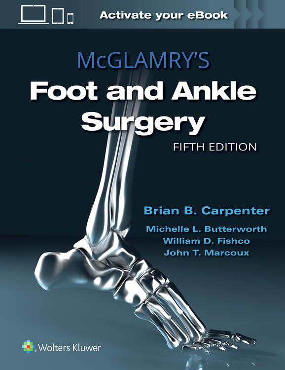 McGlamry's Foot and Ankle Surgery