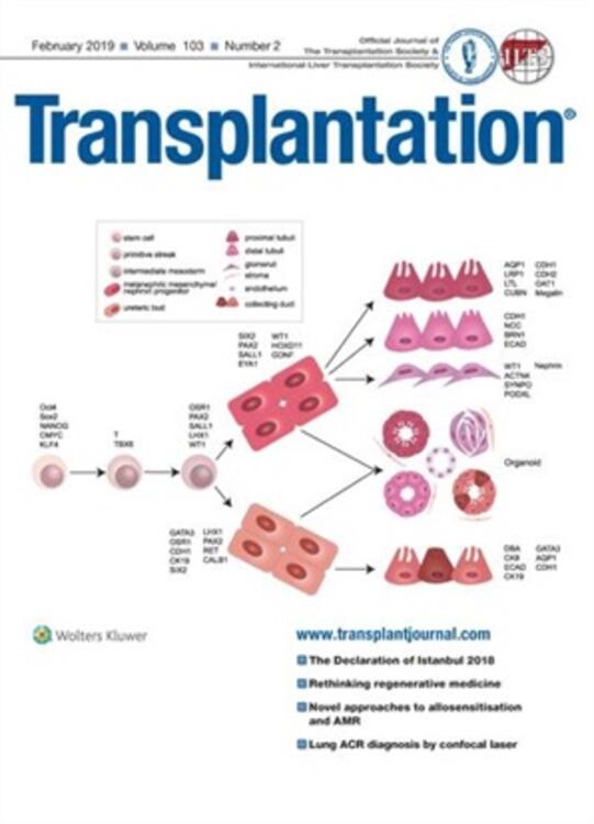 Transplantation® Online