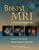 Breast MRI: A Practical Approach