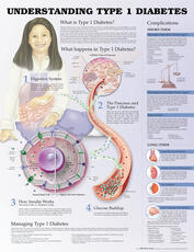 Understanding Type 1 Diabetes Anatomical Chart