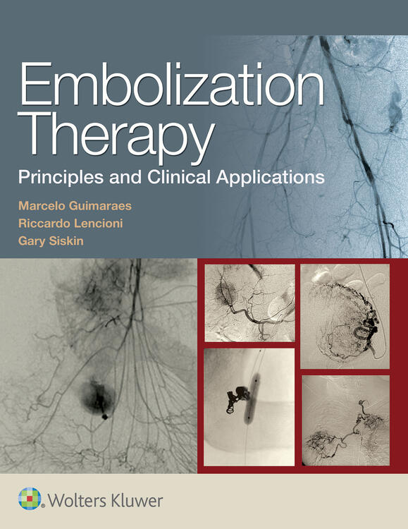 Embolization Therapy: Principles and Clinical Applications