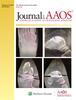 JAAOS®,  - Journal of the American Academy of Orthopaedic Surgeons