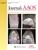 JAAOS®,  - Journal of the American Academy of Orthopaedic Surgeons