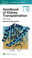 Handbook of Kidney Transplantation