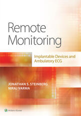 Remote Monitoring: implantable Devices and Ambulatory ECG