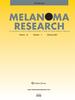 Melanoma Research