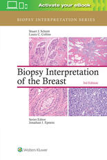 Biopsy Interpretation of the Breast