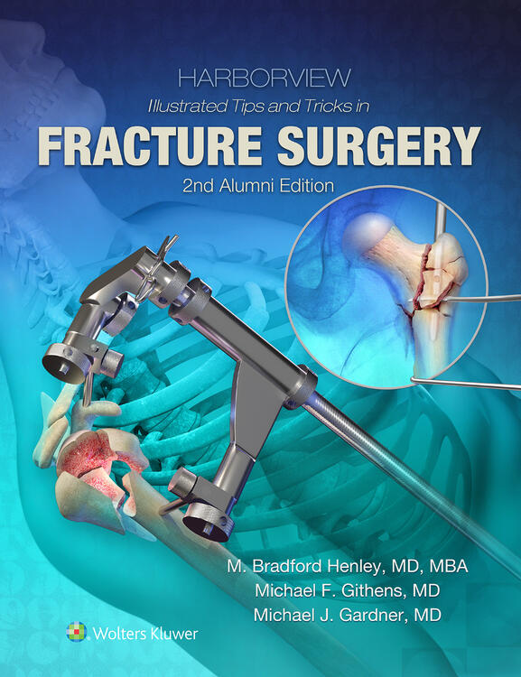 Harborview Illustrated Tips and Tricks in Fracture Surgery