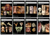 Acland’s Video Atlas of Human Anatomy Collection
