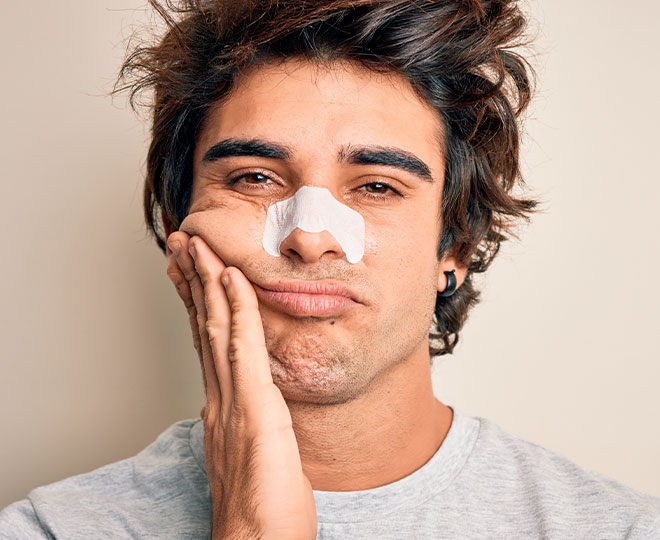 What causes blackheads?