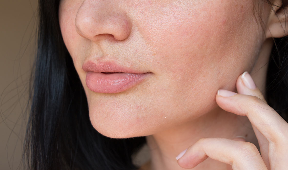 The top four myths about your pores – debunked